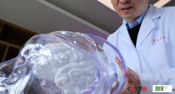  В Китае одобрено первое в мире имплантируемое устройство «мозг-компьютер»